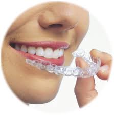 Clear Aligners - No Braces